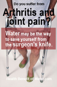 Arthritis and Joint pain infographics